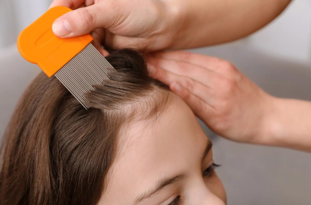 ochrona przed wszawicą